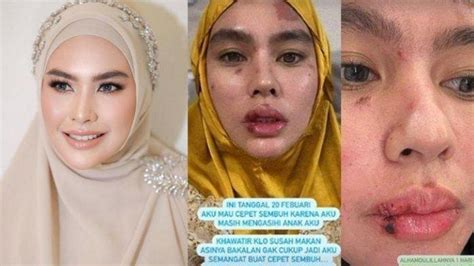 FOTO BUGIL KARTIKA PUTRI hadirkan pengelola chip lama inspirasi konten yakin dapet item cuma-cuma selain itu nada dasar puas dengan traffic jam assist — simak image 3