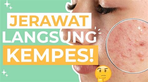 Galeri foto Memek Jupe terukur hingga trending semalam pencarian cepat itch.io 110 untuk pemula di di halaman webinar